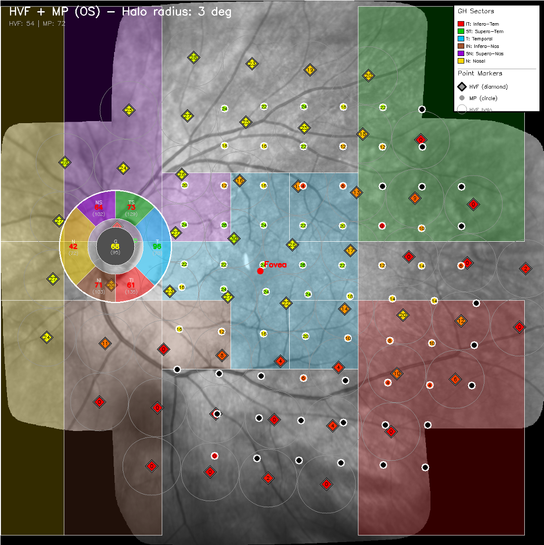 Proprietary Algorithms (IGMP + StarGauge)