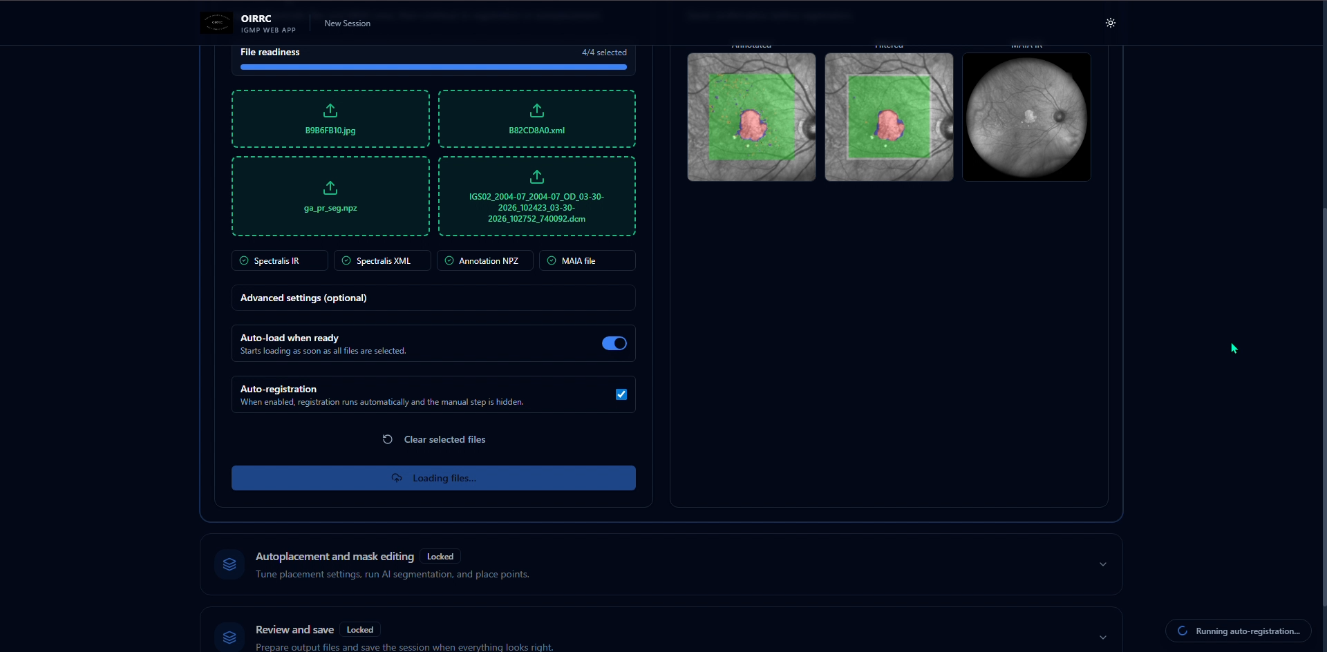 Proprietary Algorithms (IGMP + StarGauge)