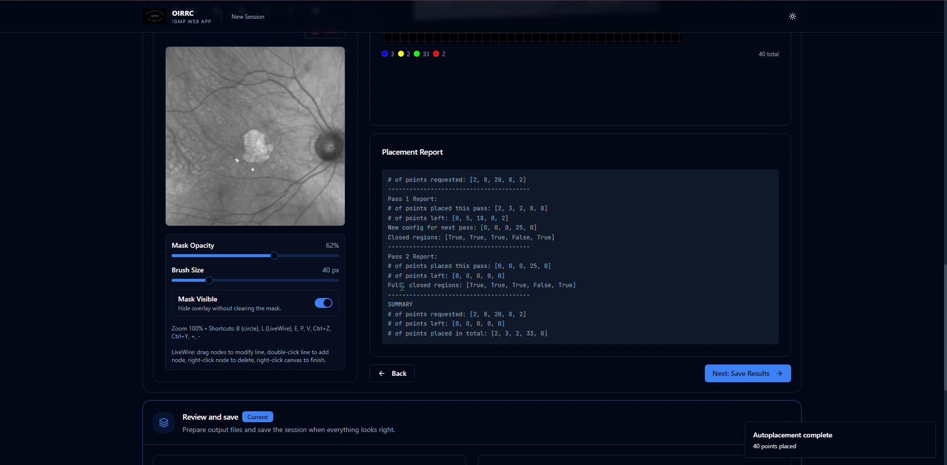 Proprietary Algorithms (IGMP + StarGauge)